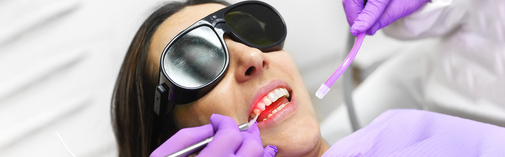 A Guide to Laser Therapy for Cavity Treatment: Say Goodbye to the Drill